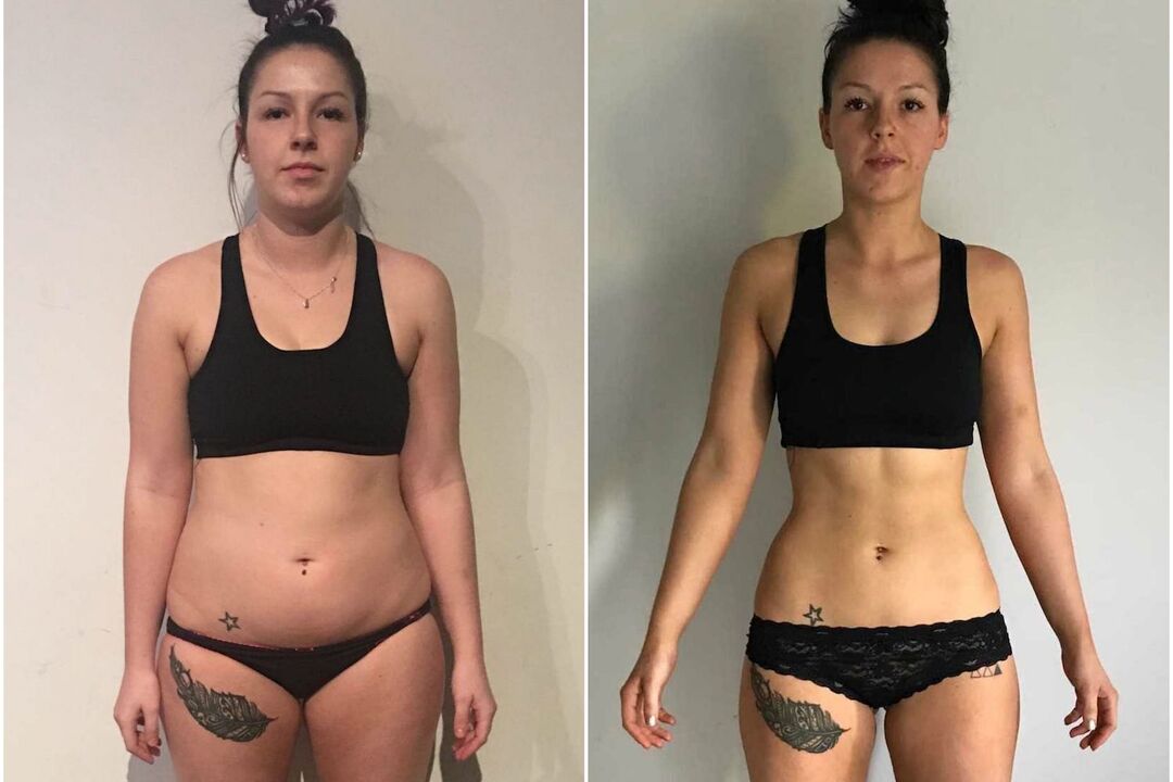 antes e despois da perda de peso